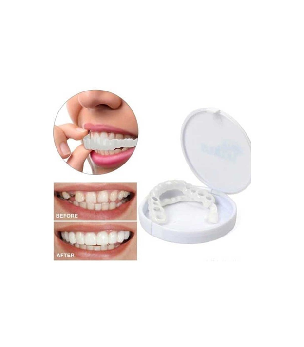 لمینت متحرک دندان چیست؟