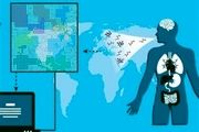 ام اس به راحتی قابل تشخیص است