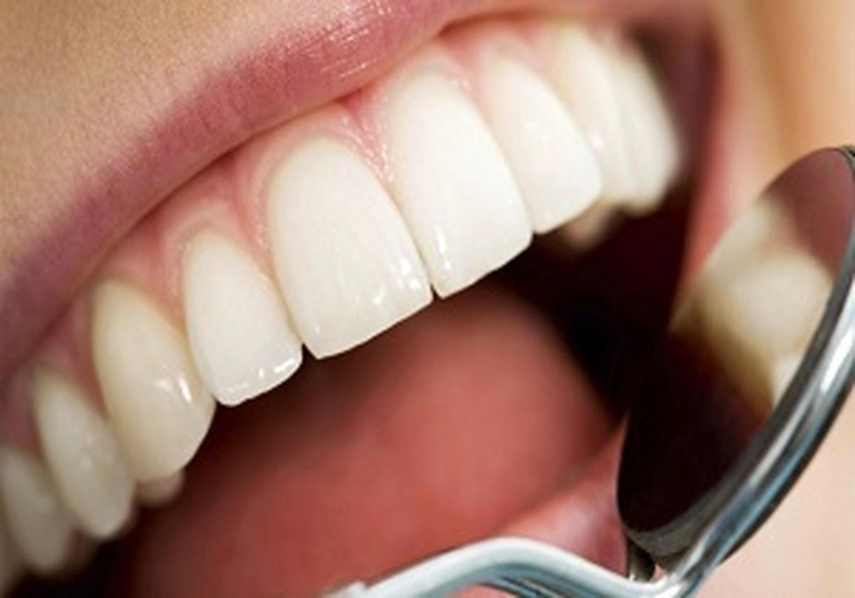 چه زمانی برای «ایمپلنت» دندان مناسب است؟