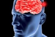 از بیماری «آنوریسم» چه می‌دانید؟