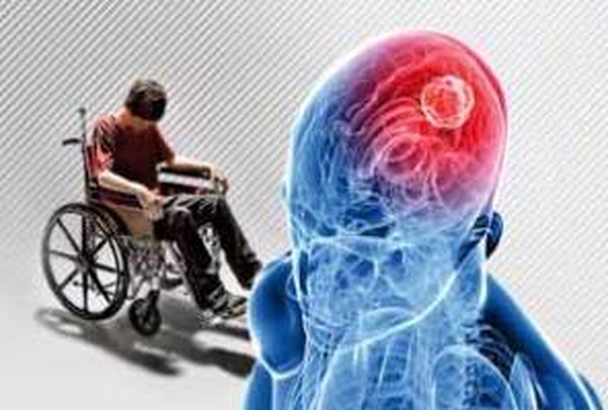 رژیم غذایی در کنترل بیماری ام اس چه نقشی دارد؟