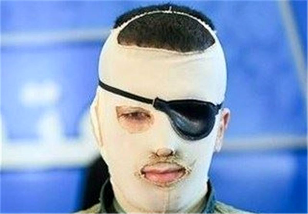 اسیدپاشی مرگبار به مرد جوان در تهران