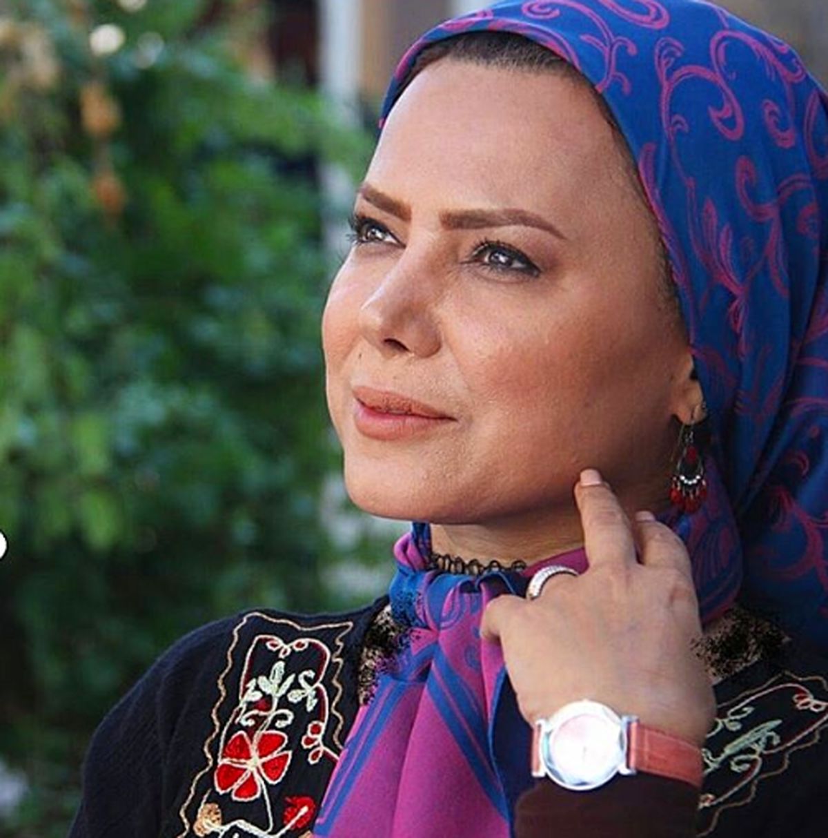 حال و روز بد خانم بازیگر با ظاهری شوکه‌کننده/ فیلم