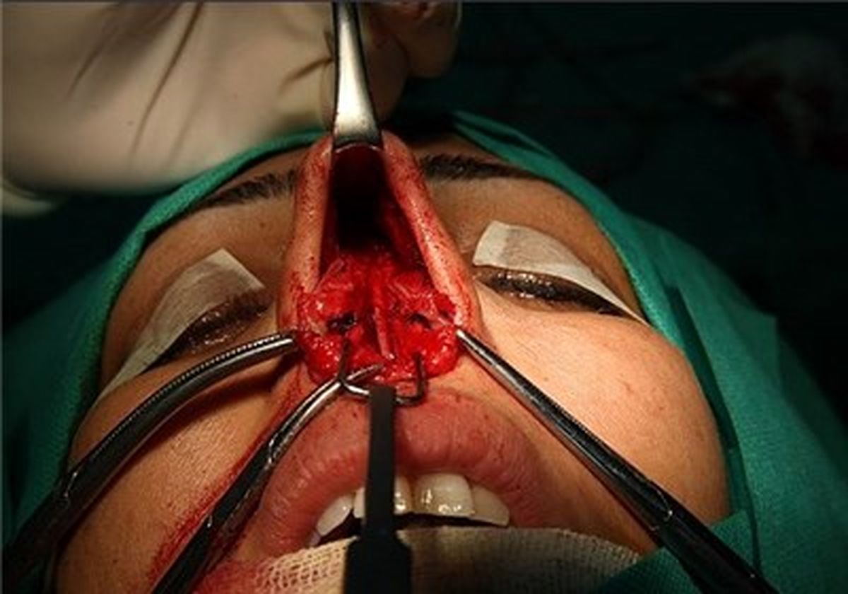 افزایش پرونده‌های قصور پزشکی