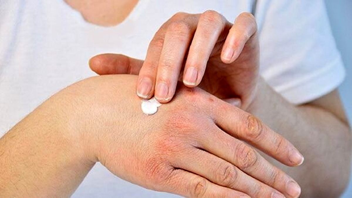 چرا پوستمان خشک می‌شود؟
