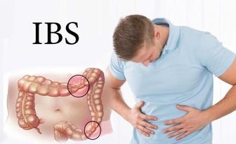 مواد غذایی مفید برای سندرم روده تحریک پذیر

