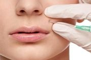 عوارض احتمالی تزریق ژل و فیلر در صورت 