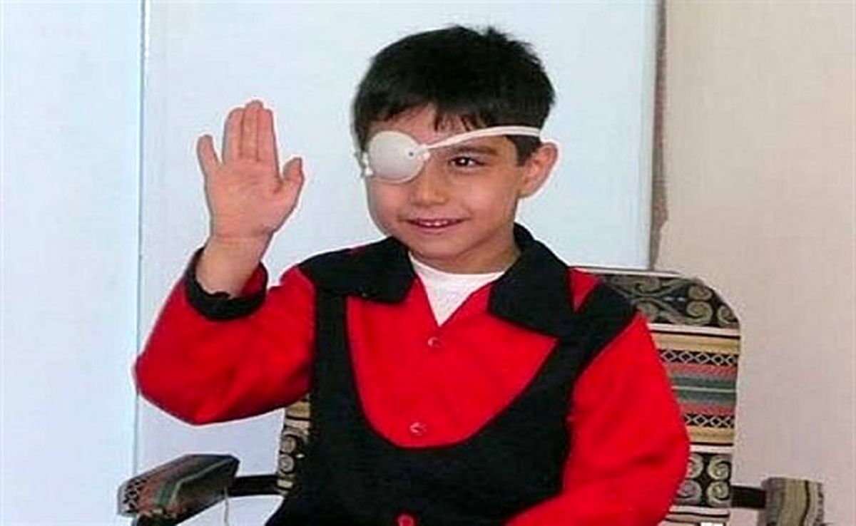 انحراف چشم کودکان چگونه درمان می‌شود؟
