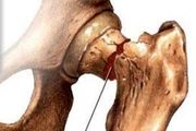 کمبود این ویتامین را جدی بگیرید