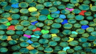 میکروژل‌های ترمیم‌کننده آسیب‌های مغزی
