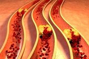 نشانههای هشداردهنده مصرف بیش از حد چربی + جزئیات