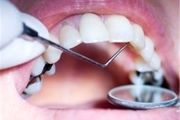 خبرهای خوش دندانپزشکی از زبان وزیر بهداشت