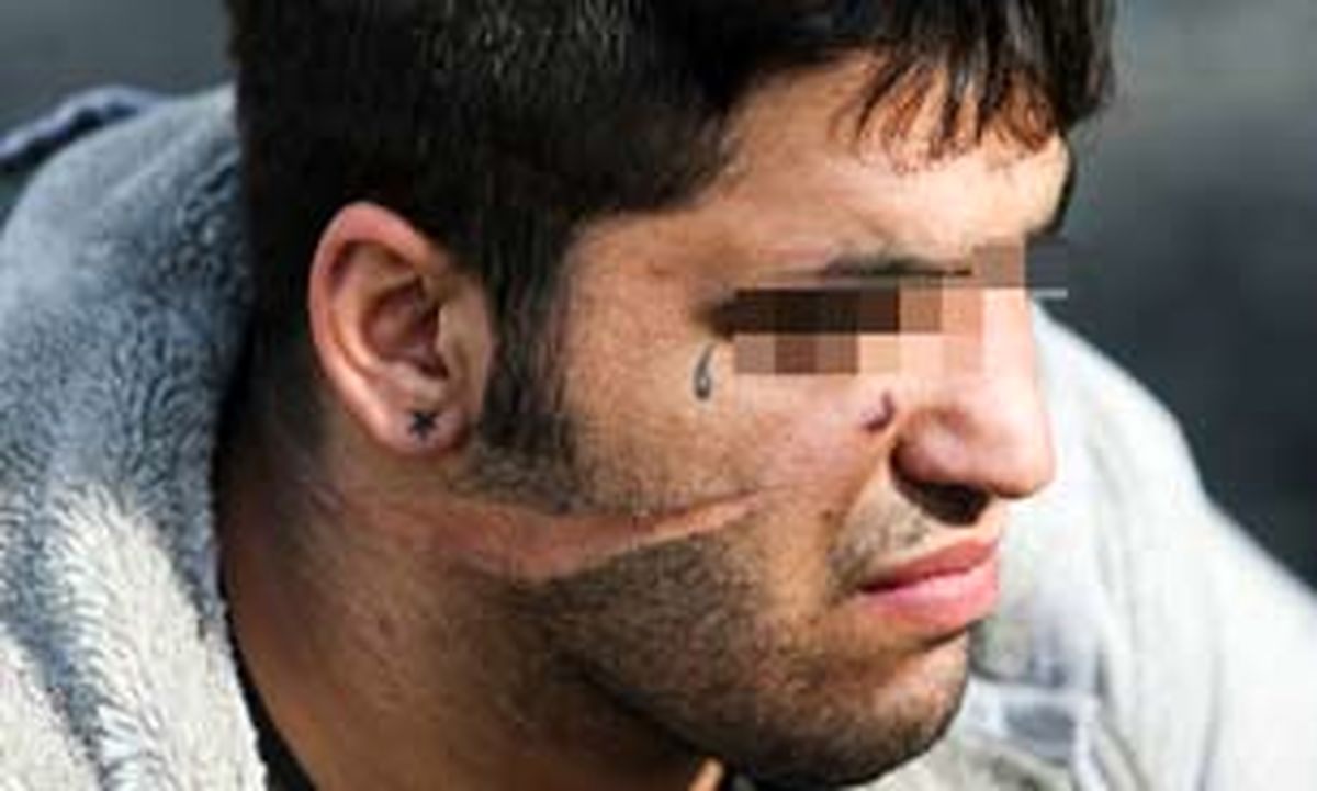 چاقو کشی بر روی مامور پلیس راهور