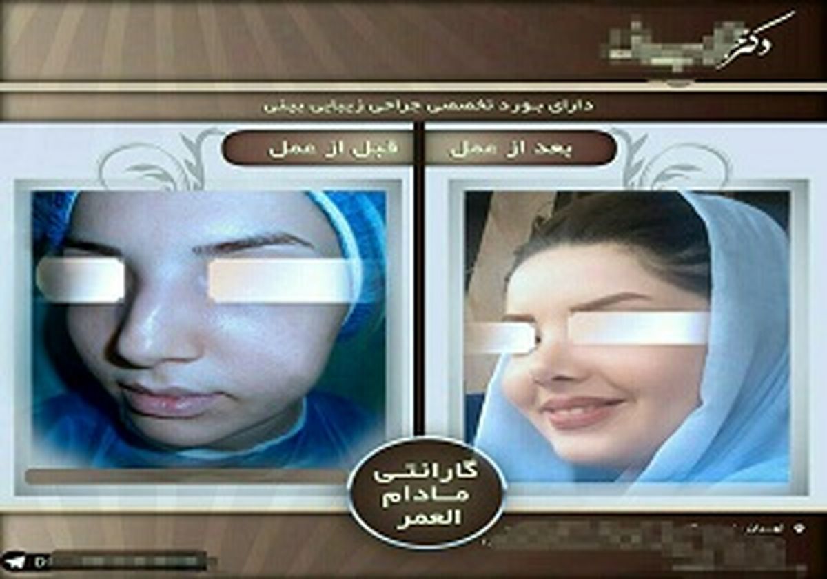 تمایل به جراحی بینی از کجا نشأت می گیرد؟
 