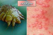 گال چیست و برای درمان آن باید چه کار کرد؟

