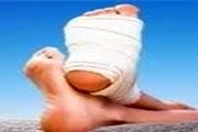 اولین اقدام اورژانسی هنگام پیچ‌خوردگی مچ پا