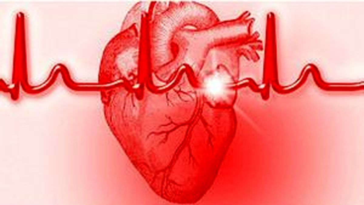 سکسکه‌ و حمله قلبی چه رابطه ای با یکدیگر دارند؟