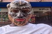 عمل جراحی عجیب از جوان 32 ساله موجودی شبیه هیولای فضایی ساخت +عکس