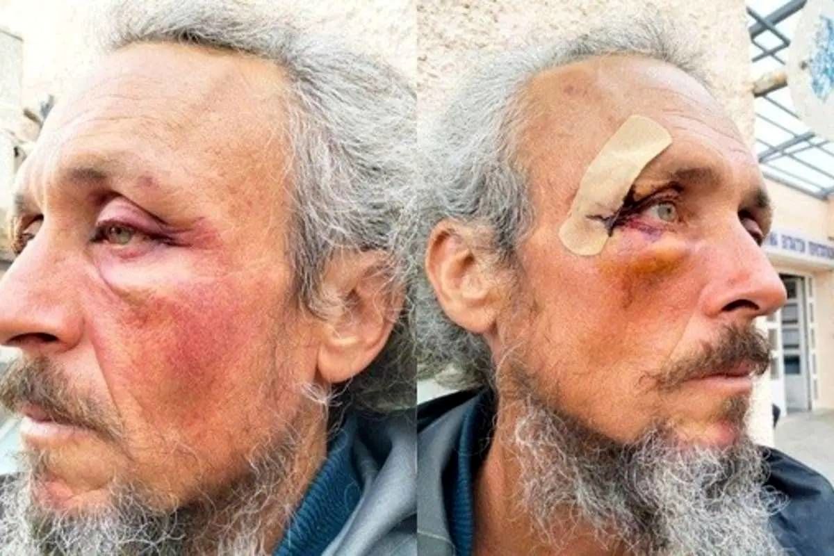 جزئیات شکنجه ۴۰ ساعته فعالان کاروان صمود