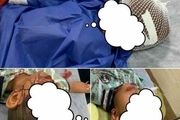 سگ هار پوست سر کودک ۷ ساله بندرعباسی را کند! + عکس