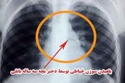 
سوزن خیاطی در نای دختر بچه بابلی
