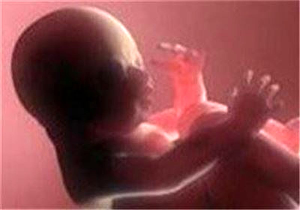 MRI در بارداری برای جنین مشکلی ایجاد نمی‌کند