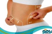 هزینه لیپوماتیک توسط بهترین پزشک در سال 1401 چقدر است ؟

