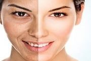 ابداع روشی جدید برای کاهش آثار زخم