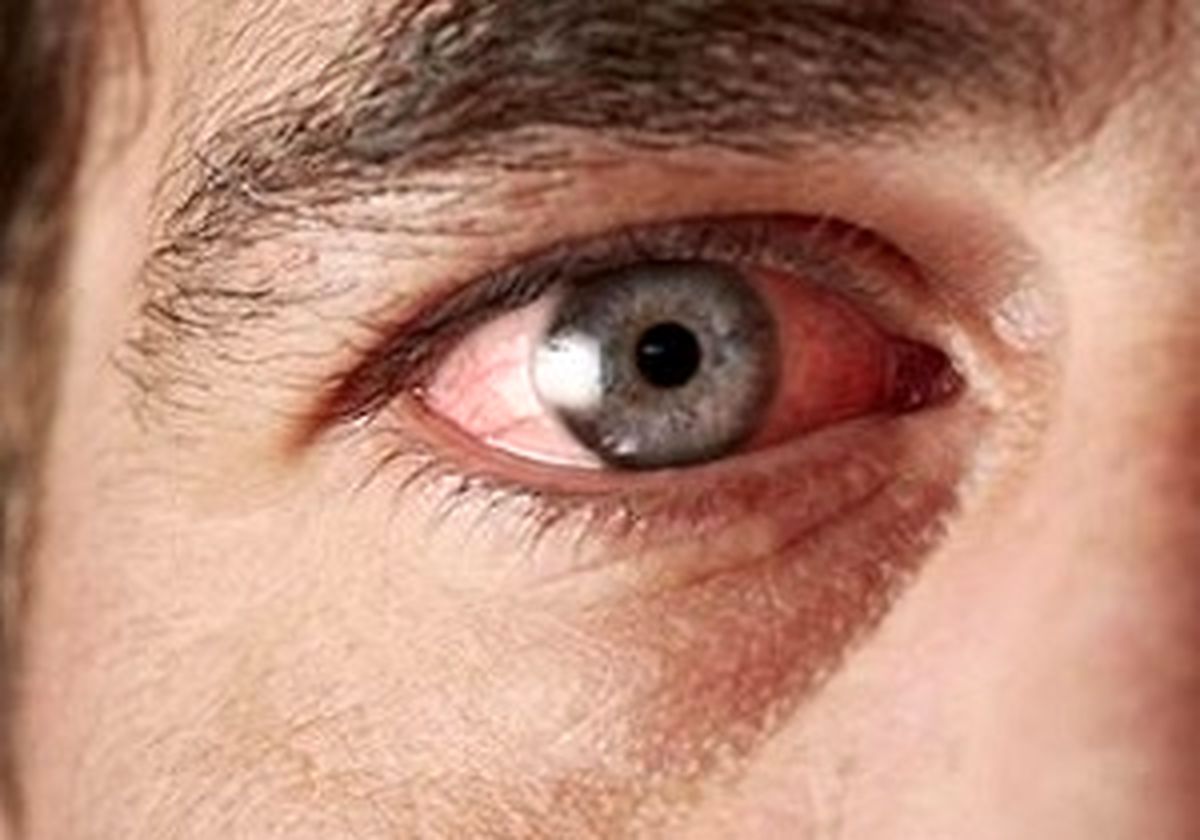 بینایی خود را اینگونه تقویت کنید