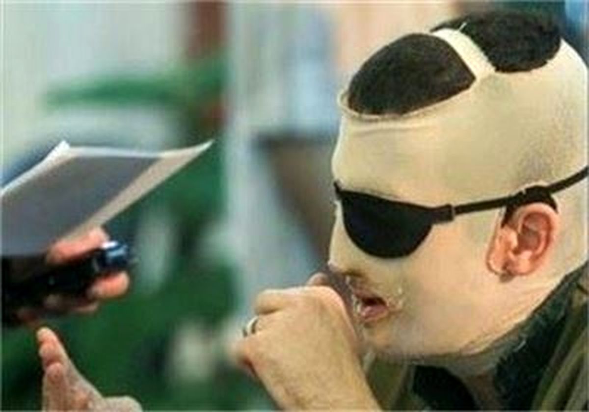 قربانی اسیدپاشی: منتظر اعلام‌نظر رئیس قوه‌قضاییه